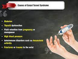 What Is Carpal Tunnel Syndrome