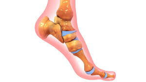 Tulang sesamoid (2 tulang bulat kecil yang terletak di ujung bawah tulang metatarsal ibu jari kaki) juga bisa mengalami patah tulang. Cara Memperkuat Pergelangan Kaki