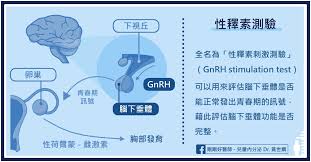 Image result for GnRH Stimulation Test