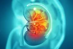 Image result for how many stones can be crushed in one treatment