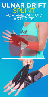 Pin On Hand