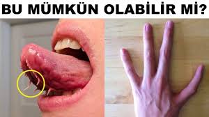 Insan Vucudundaki 20 Garip Mutasyon Youtube