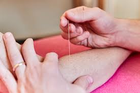 Tennis elbow is elbow pain due to inflammation of the tendons in the forearm that attach to the while it's true that tennis players are most likely to develop this painful problem, tennis elbow is a. How To Treat Tennis Elbow Kennington Osteopaths Physiotherapy