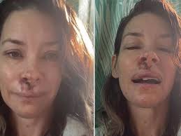 Marvel's Evangeline Lilly reveals gruesome injuries after being rushed to  hospital