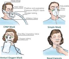 Nasal cannulas are the most popular option for delivering supplemental oxygen to people who find a variety of cannula lengths and styles are available with features like straight prongs, flared or tilted respironics recommends that new patients purchase their devices, masks and initial accessories. Oxygen Administration
