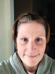 Severe pain during bowel movements at 3am?