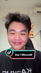 Gary Justin Hairline