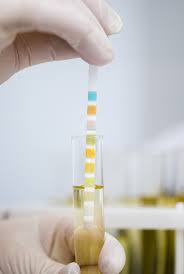 Deshidratarea este o altă problemă ce poate apărea în urma scaunelor diareice repetate. Managementul Si Tratamentul InfecÅ£iilor Urinare Bacteriene