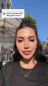 Sonya Syed Nose Before