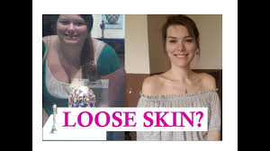 Keto What About Loose Skin Loose Skin Keto My Diet Plan