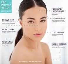 Переглядів 351 тис.11 років тому. Botox Injections Treatments Prices Uk Near Me Botox Skin Clinics