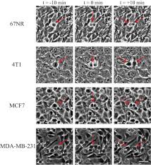 They divide by meiosis to produce gametes for sexual organisms need to repair damaged tissue. Dynamics Of Cancerous Tissue Correlates With Invasiveness Scientific Reports