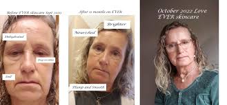 Hello Lovely people! It's a beautiful sunny day here in Devon, but also  very cold! I often find my skin struggles this time of year because of it.  Soothe is my saviour!