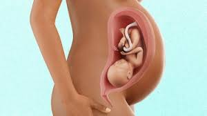 This conversion of 38 weeks to months has been calculated by multiplying 38 weeks by 0.2299 and the result is 8.7385 months. 38 Weeks Pregnant Pregnancy Week By Week