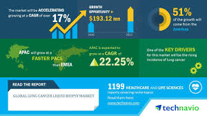 While the coughing and bronchitis can cause discomfort, there are other, more painful symptoms — bone aches and. Americas Tops The Global Lung Cancer Liquid Biopsy Market Technavio Business Wire