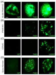 Druk air (royal bhutan airlines). Measles Encephalitis Towards New Therapeutics Abstract Europe Pmc