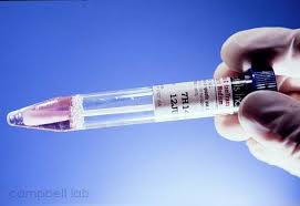 Image result for Herpes Simplex Virus Testing