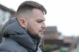 I drank so much lager my skin turned yellow like Homer Simpson