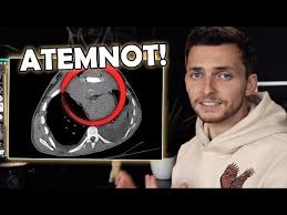 Maybe you would like to learn more about one of these? Youtube Star Philipp Mickenbecker Der Tumor Verschiebt Das Herz
