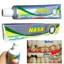 Jual Nasa Pasta Gigi Original Online Desember 2020 Blibli