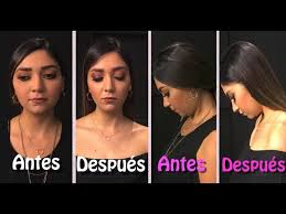 Sin Cirugia Reduccion De Mejillas Y Papada Youtube Después de leer los poemas sobre el método científico y la ciencia. sin cirugia reduccion de mejillas y