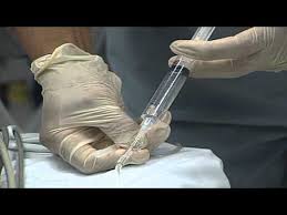 More Men Facing Hpv Throat Cancer Youtube