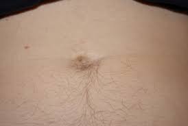 Wann ein nabelbruch in der schwangerschaft operiert werden sollte. Ambulante Nabelbruch Op Durch Spezialist Munchen