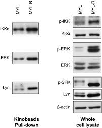 Bitte wählen sie die richtigen. Global Discovery Of Protein Kinases And Other Nucleotide Binding Proteins By Mass Spectrometry Abstract Europe Pmc
