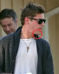 Zac made a quick appearance in the musical and fans immediately noticed his jawline is looking much. Zac Efron Displays Swollen Face And Large Scar On His Chin After Accident Which Saw His Jaw Wired Shut Daily Mail Online