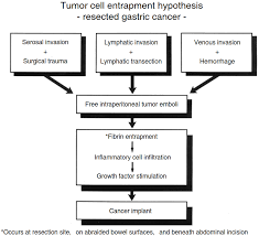 Stomach cancer (or gastric cancer) is one of the more uncommon forms of cancer, but unfortunately, it is also one of the most dangerous.this is because in its early stages, stomach cancer does not cause many symptoms, and its symptoms can easily be mistaken for something else. Gastric Cancer Prevention And Treatment Of Peritoneal Metastases