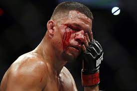 Nate diaz | нейт диаз. Has Nate Diaz Lost His Spot As People S Champ After Skipping Out On Ufc 230 Bleacher Report Latest News Videos And Highlights