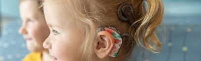 Image result for Cochlear Implant