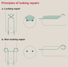 The modified kessler (106.3 n. Principles Of Tendon Repair Surgery Oxford International Edition