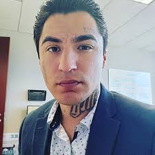 LLU's new Tattoo Removal Program helps Inland Empire patients reset, aims  to curb violence