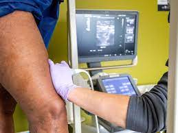 9 Ways To Improve Circulation & Blood Flow | Vein Clinics Of America