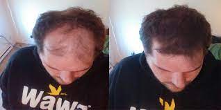 By spraying some hair spray onto your clothes you can fix a very annoying problem and make sure your clothes will look pretty for much longer! Resolution 111 Buy And Try Spray On Hair