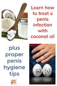 Coconut Oil for Balanitis and Other Penile Infections | Hybrid Rasta Mama