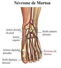 Epingle Sur Neuropathie