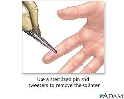 This will soften the skin and ring the splinters to the surface. Splinter Removal Medlineplus Medical Encyclopedia