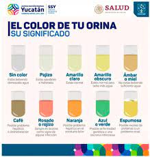 Mi Orina Es Muy Amarilla Y Espumosa Causas De Solfa Syllable Pis Espumosa En Que Momento Debes Preocuparte
