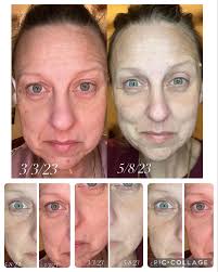 Finally got some AGS-safe marine collagen. Hopefully my skin, hair, and  nails will be happier now! Mixed it into some chicken bone broth, since I  can't sleep and my stomach is growling.