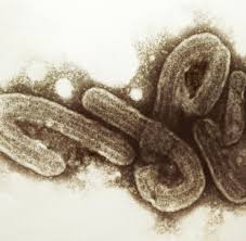 Marburg virus disease was initially detected in 1967 after simultaneous outbreaks in marburg and frankfurt in germany; Marburg Virus Ansteckung Infektion Symptome Welt