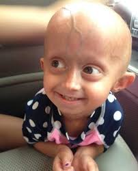 Progeria Research Foundation
