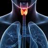 Thyroid Cancer Medullary Carcinoma Medlineplus Medical Encyclopedia