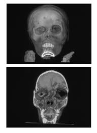 Remember when we scanned the Inca Ice...