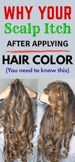 Itchy Scalp After Hair Color Here S Everything You Need To Know Scalp Itch Hair Color Hair Shampoo