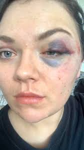 Do you know who carried out this attack? A woman is recovering today after  being “punched and kicked” in The Pink Toothbrush nightclub in Rayleigh  last night. Dannielle Briggs recalled what happened