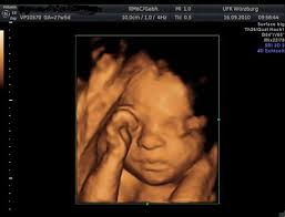 Bis dahin wussten werdende eltern nur in etwa, wann ihr nachwuchs kommt, mussten rätseln, welches geschlecht das baby wohl haben würde und mussten hoffen, dass. Dein Baby In 3d Was Bietet Ein 3d Ultraschall Und Wann Ist Er Erlaubt Netmoms De