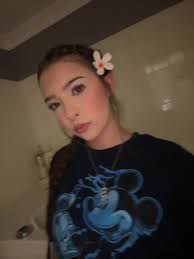 715 Bella Skinner Before and After