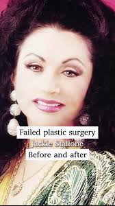 Transgender celebrities, before and after. #celebrity #entertainment #...